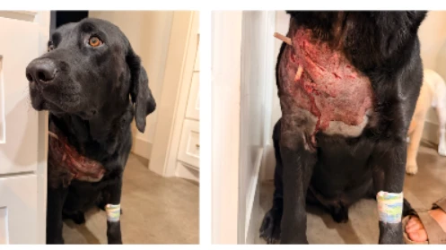 Ten-year-old Bobby standing bravely during treatment for a serious wound across his chest and shoulder