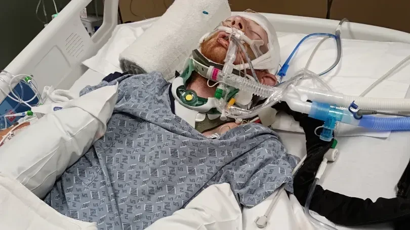 Jonah lying unconscious in an ICU bed, intubated and wearing a neck brace after a drunk-driving crash